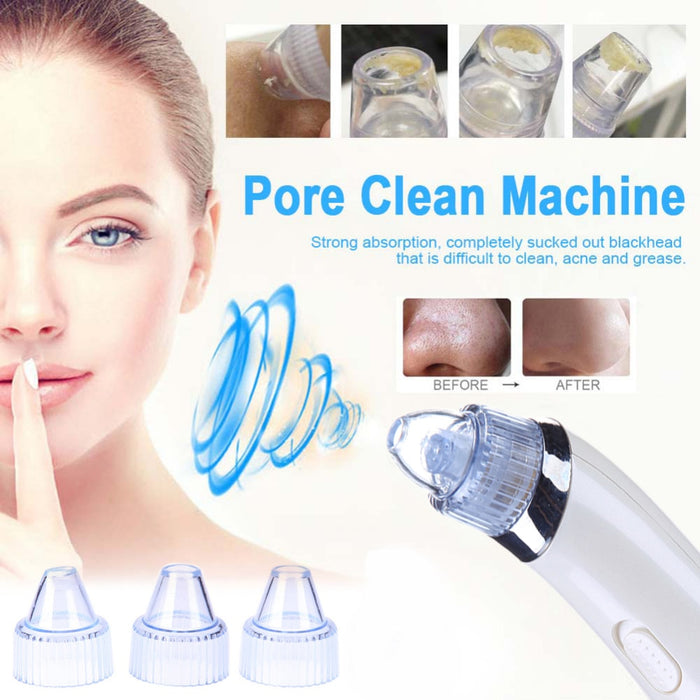 Pore Cleanser Vacuum Blackhead Remover Johnny O's Goods